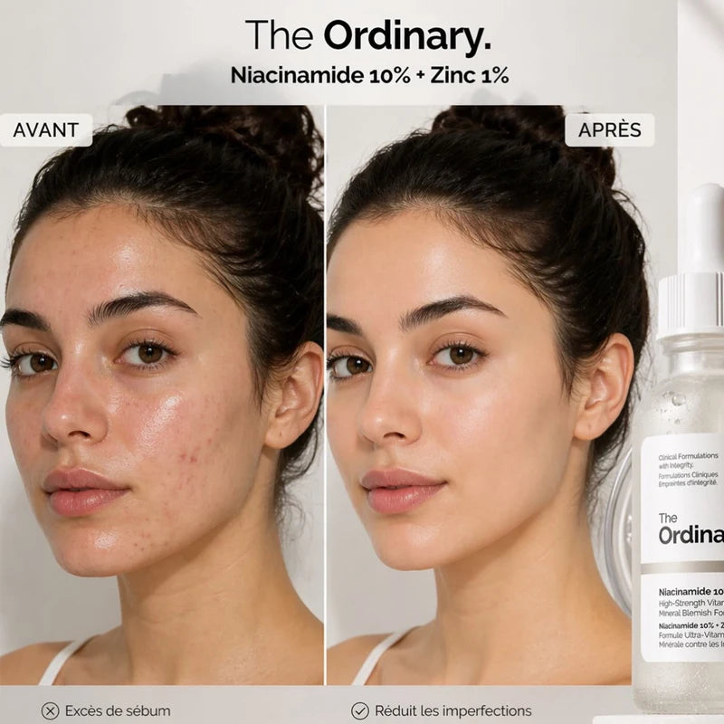 The Ordinary Serum 30ml Essence Suitable for Acne-prone Skin Can Smooth Brighten Support The Skin