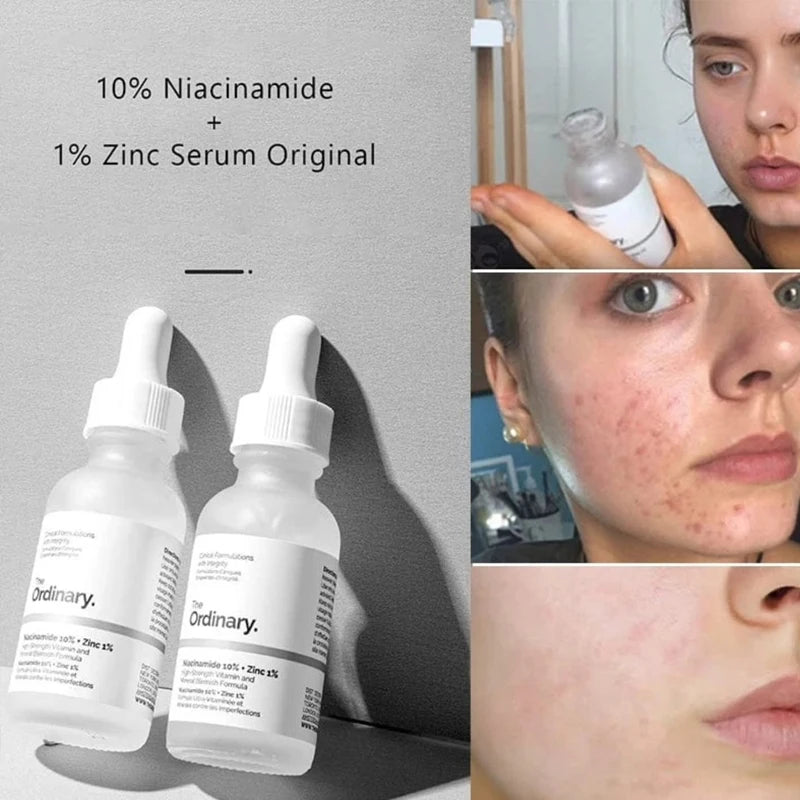 The Ordinary Serum 30ml    Essence Suitable for Acne-prone Skin Can Smooth Brighten Support The Skin